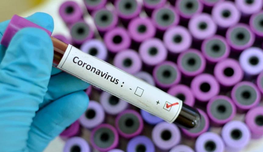 Coronavírus: O que é e qual seu impacto para o mundo?